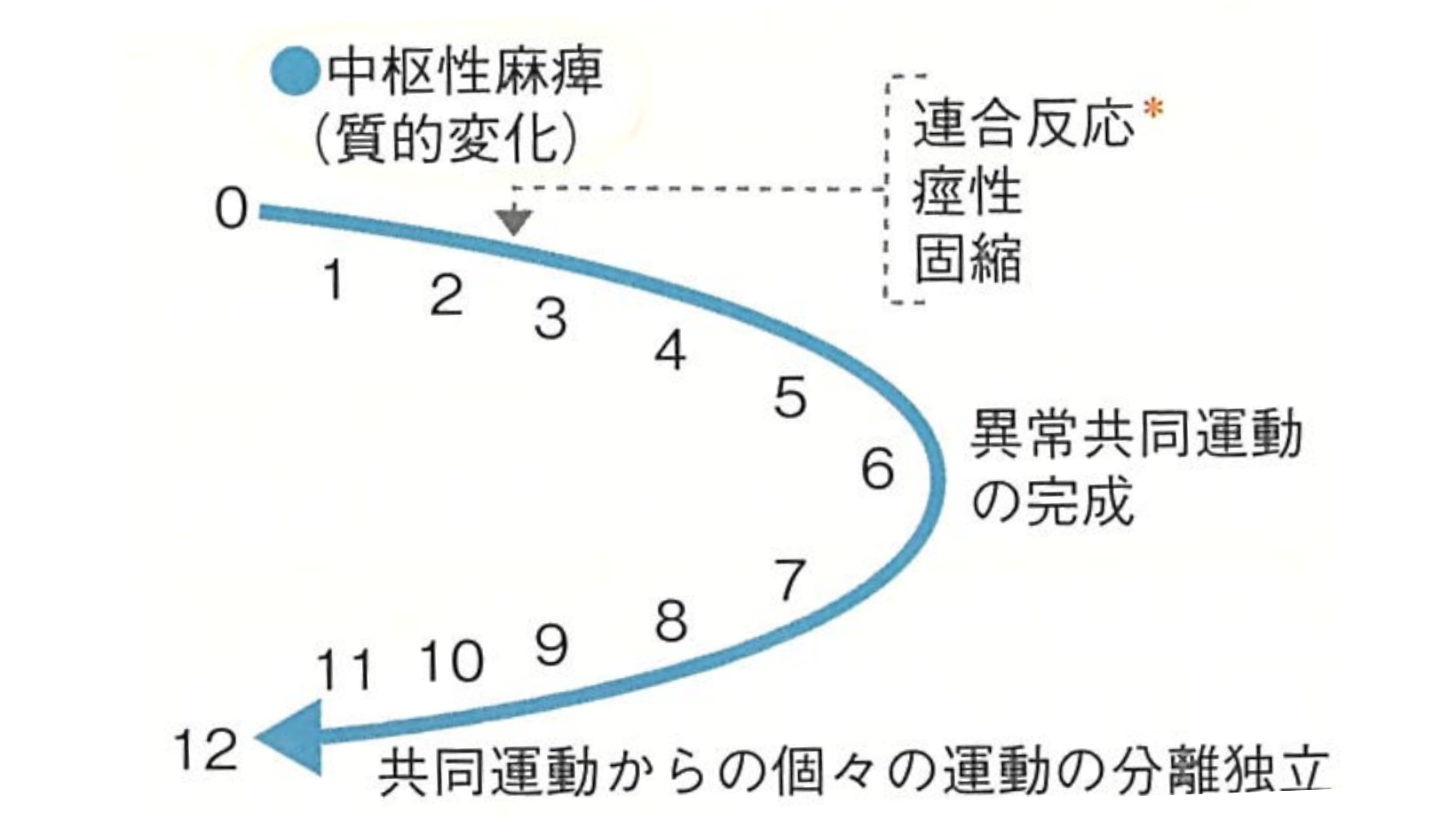 麻痺とは？ －What`s MAHI？－ 運動麻痺の症状 - いちかわ魚屋整体 with Overlization